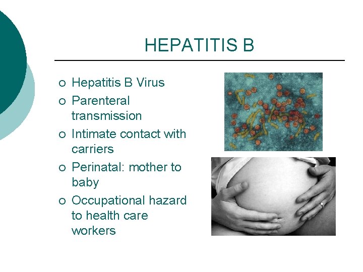 HEPATITIS B ¡ ¡ ¡ Hepatitis B Virus Parenteral transmission Intimate contact with carriers