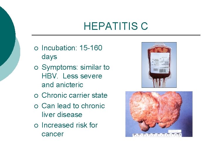 HEPATITIS C ¡ ¡ ¡ Incubation: 15 -160 days Symptoms: similar to HBV. Less