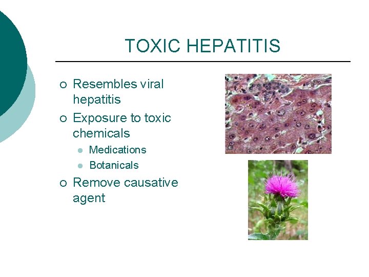 TOXIC HEPATITIS ¡ ¡ Resembles viral hepatitis Exposure to toxic chemicals l l ¡
