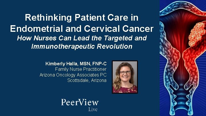 Rethinking Patient Care in Endometrial and Cervical Cancer