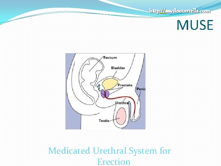 http: //mydoctortells. com MUSE Medicated Urethral System for Erection 