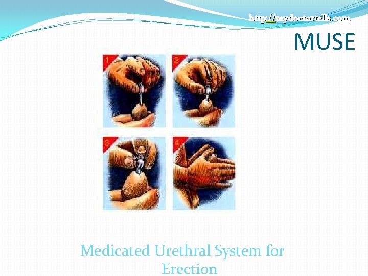 http: //mydoctortells. com MUSE Medicated Urethral System for Erection 