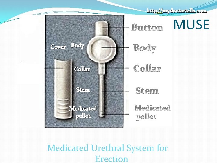 http: //mydoctortells. com MUSE Cover Body Collar Stem Medicated pellet Medicated Urethral System for