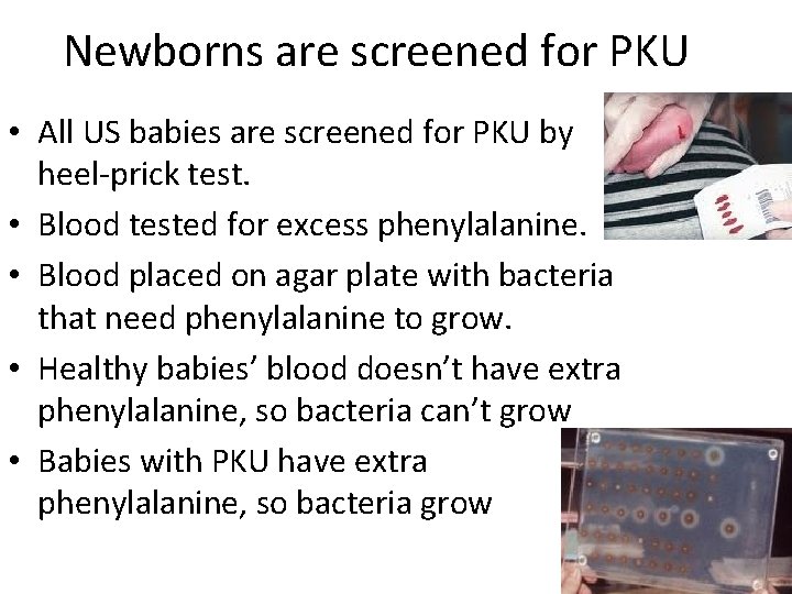 Newborns are screened for PKU • All US babies are screened for PKU by