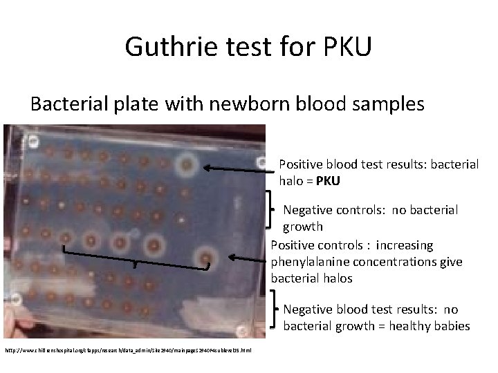 Guthrie test for PKU Bacterial plate with newborn blood samples Positive blood test results: