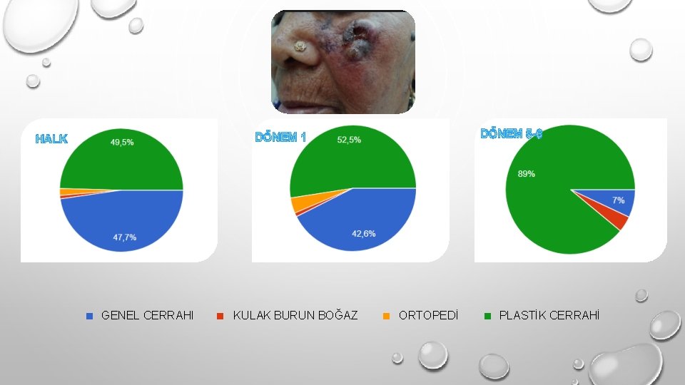 SONUÇ DÖNEM 5 -6 DÖNEM 1 HALK . GENEL CERRAHI . KULAK BURUN BOĞAZ