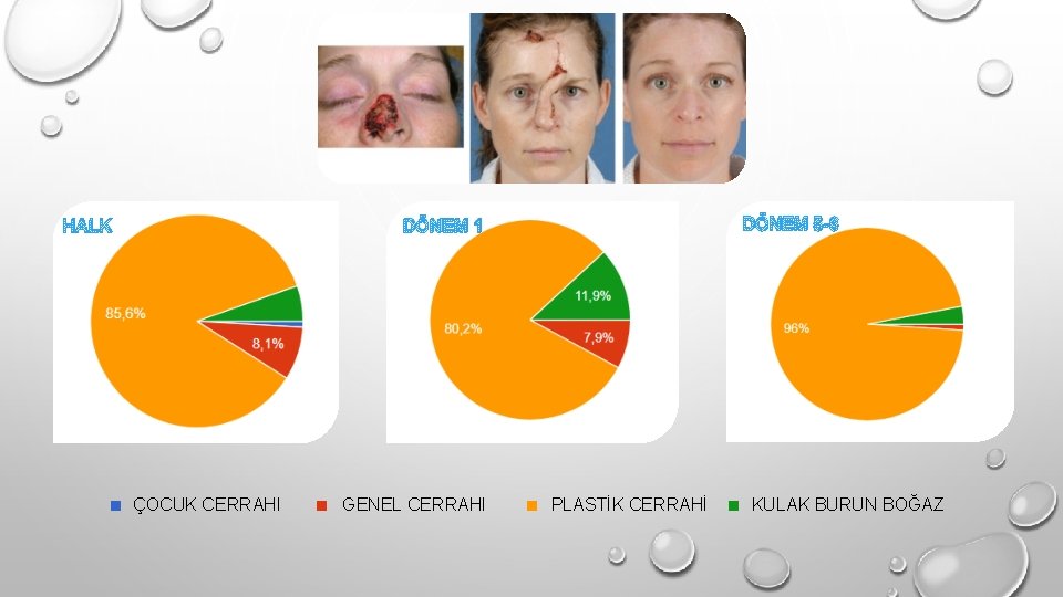 HALK . DÖNEM 5 -6 DÖNEM 1 ÇOCUK CERRAHI . GENEL CERRAHI . PLASTİK