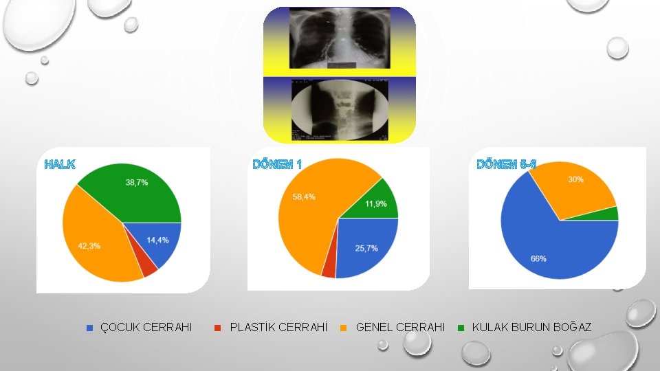 DÖNEM 1 HALK . ÇOCUK CERRAHI . PLASTİK CERRAHİ DÖNEM 5 -6 . GENEL