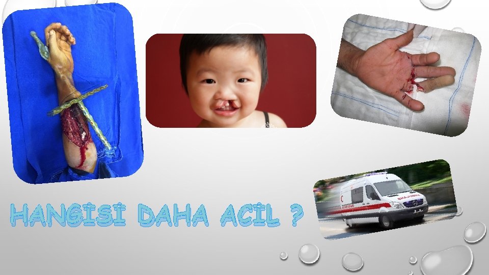 HANGİSİ DAHA ACİL ? 