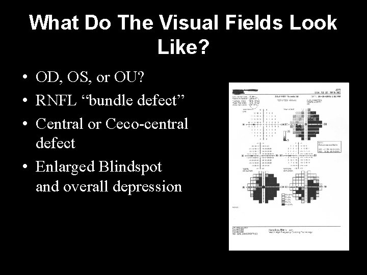 What Do The Visual Fields Look Like? • OD, OS, or OU? • RNFL