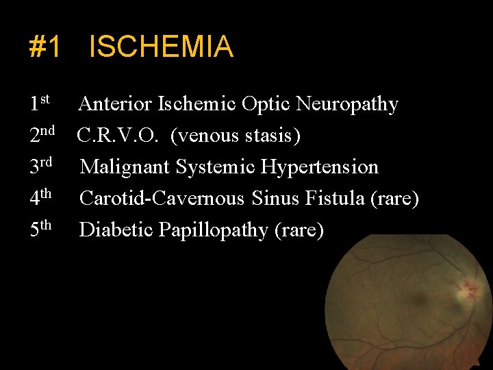 #1 ISCHEMIA 1 st Anterior Ischemic Optic Neuropathy 2 nd C. R. V. O.