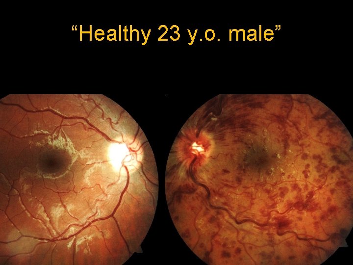 “Healthy 23 y. o. male” 