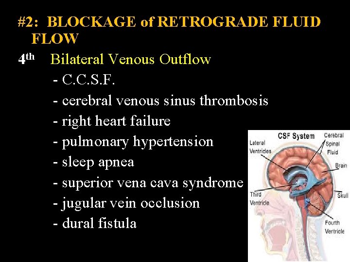 #2: BLOCKAGE of RETROGRADE FLUID FLOW 4 th Bilateral Venous Outflow - C. C.