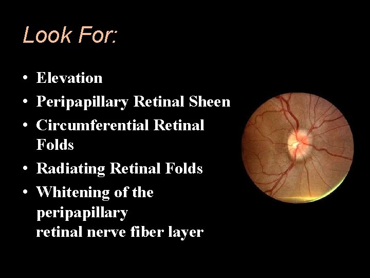 Look For: • Elevation • Peripapillary Retinal Sheen • Circumferential Retinal Folds • Radiating