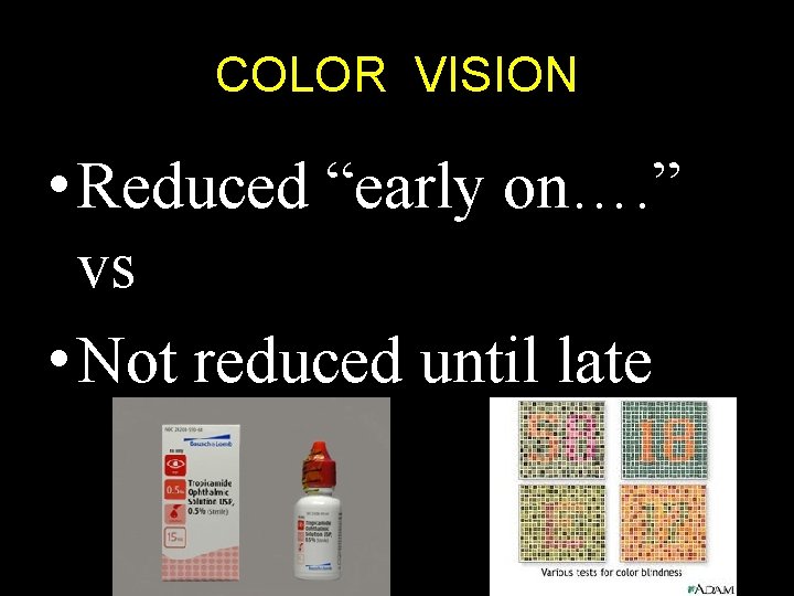 COLOR VISION • Reduced “early on…. ” vs • Not reduced until late 