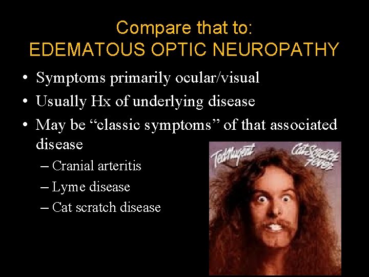Compare that to: EDEMATOUS OPTIC NEUROPATHY • Symptoms primarily ocular/visual • Usually Hx of