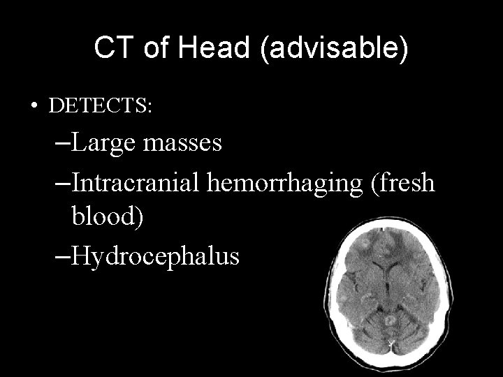 CT of Head (advisable) • DETECTS: –Large masses –Intracranial hemorrhaging (fresh blood) –Hydrocephalus 