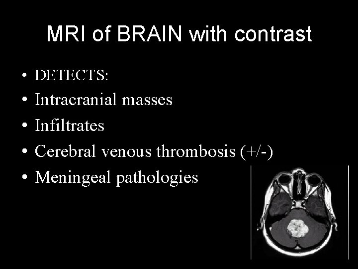 MRI of BRAIN with contrast • DETECTS: • • Intracranial masses Infiltrates Cerebral venous