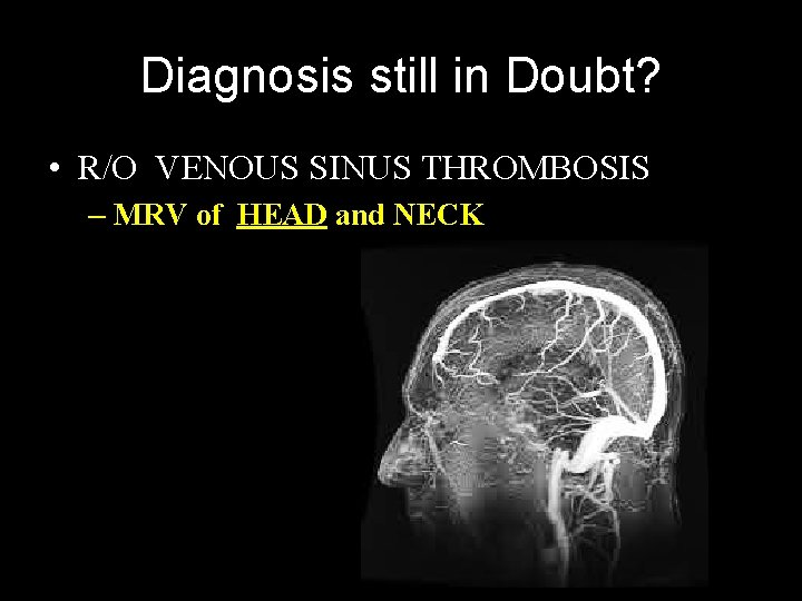 Diagnosis still in Doubt? • R/O VENOUS SINUS THROMBOSIS – MRV of HEAD and