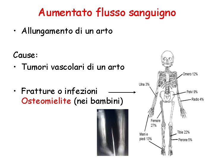 Aumentato flusso sanguigno • Allungamento di un arto Cause: • Tumori vascolari di un