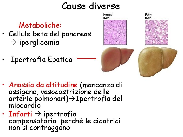 Cause diverse Metaboliche: • Cellule beta del pancreas iperglicemia • Ipertrofia Epatica • Anossia