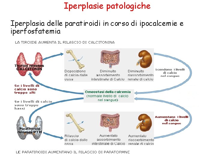 Iperplasie patologiche Iperplasia delle paratiroidi in corso di ipocalcemie e iperfosfatemia 