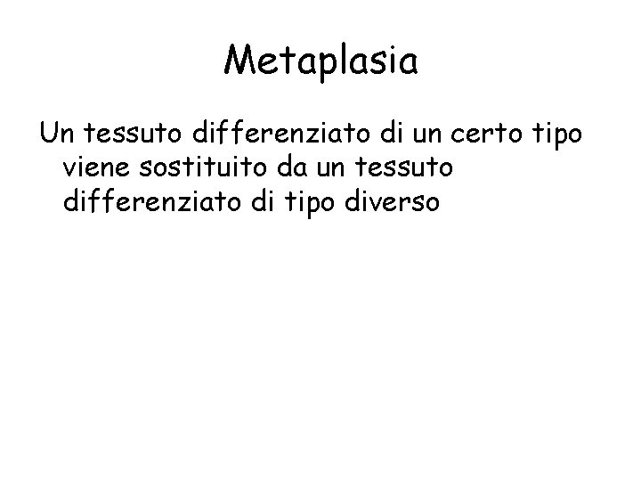 Metaplasia Un tessuto differenziato di un certo tipo viene sostituito da un tessuto differenziato