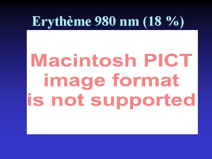 Erythème 980 nm (18 %) 