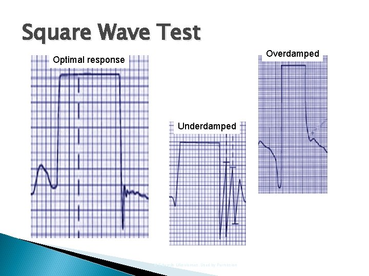 Square Wave Test Optimal response Underdamped © Edwards Lifesciences, Used by Permission Overdamped 