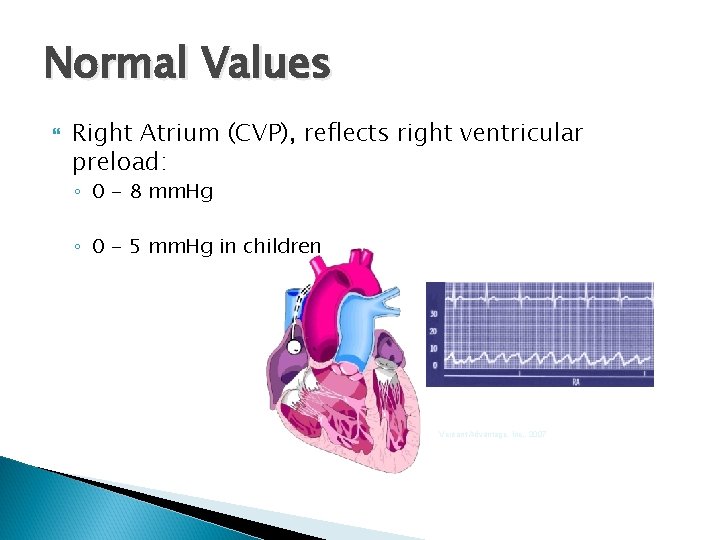 Normal Values Right Atrium (CVP), reflects right ventricular preload: ◦ 0 - 8 mm.
