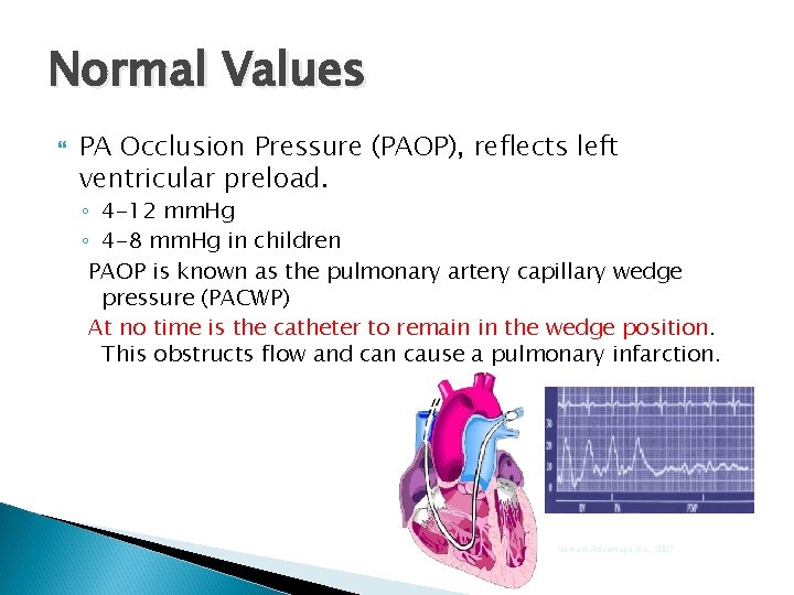 Normal Values PA Occlusion Pressure (PAOP), reflects left ventricular preload. ◦ 4 -12 mm.