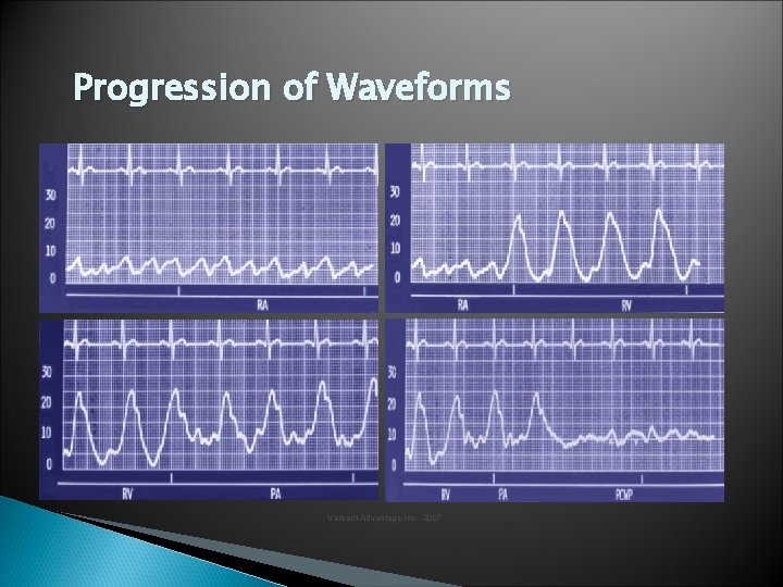Progression of Waveforms Versant Advantage Inc. , 2007 