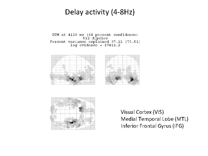 Delay activity (4 -8 Hz) Visual Cortex (VIS) Medial Temporal Lobe (MTL) Inferior Frontal