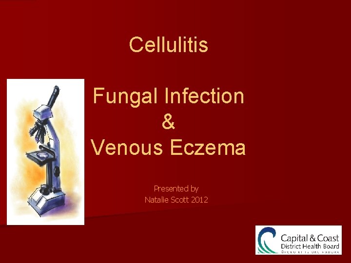 Cellulitis Fungal Infection & Venous Eczema Presented by Natalie Scott 2012 