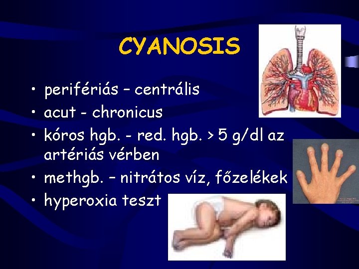 CYANOSIS • perifériás – centrális • acut - chronicus • kóros hgb. - red.