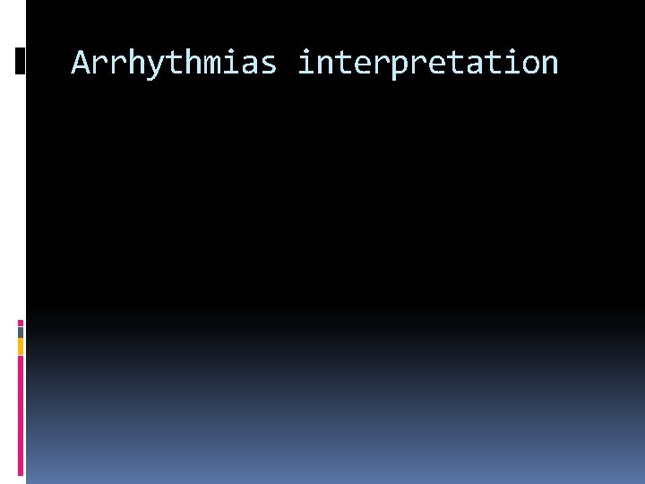 Arrhythmias interpretation 