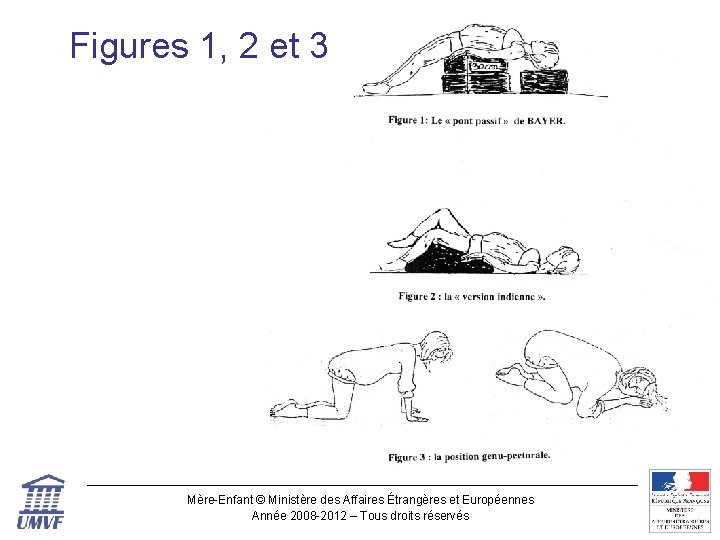 Figures 1, 2 et 3 Mère-Enfant © Ministère des Affaires Étrangères et Européennes Année