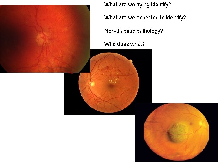 What are we trying identify? What are we expected to identify? Non-diabetic pathology? Who