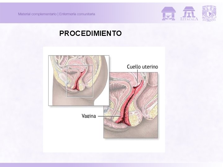 PROCEDIMIENTO 