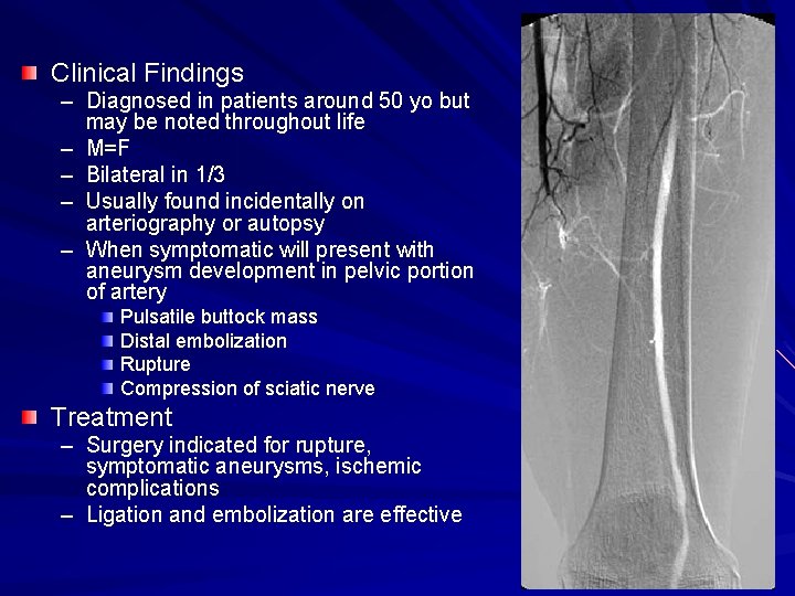 Clinical Findings – Diagnosed in patients around 50 yo but may be noted throughout