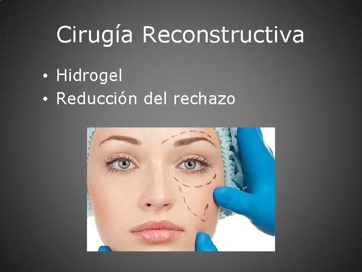 Cirugía Reconstructiva • Hidrogel • Reducción del rechazo 