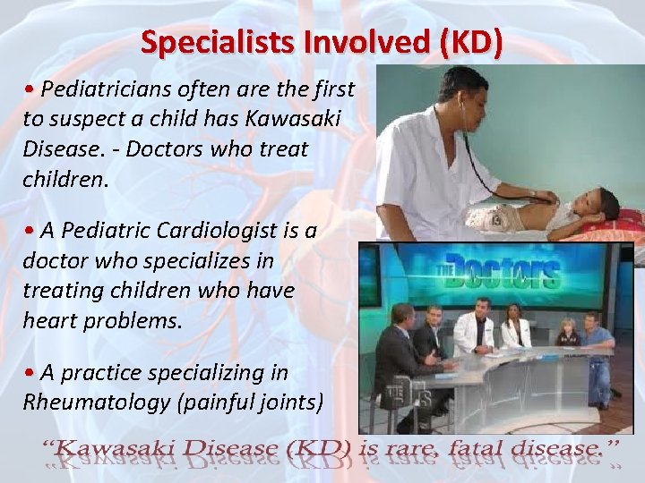 Specialists Involved (KD) • Pediatricians often are the first to suspect a child has