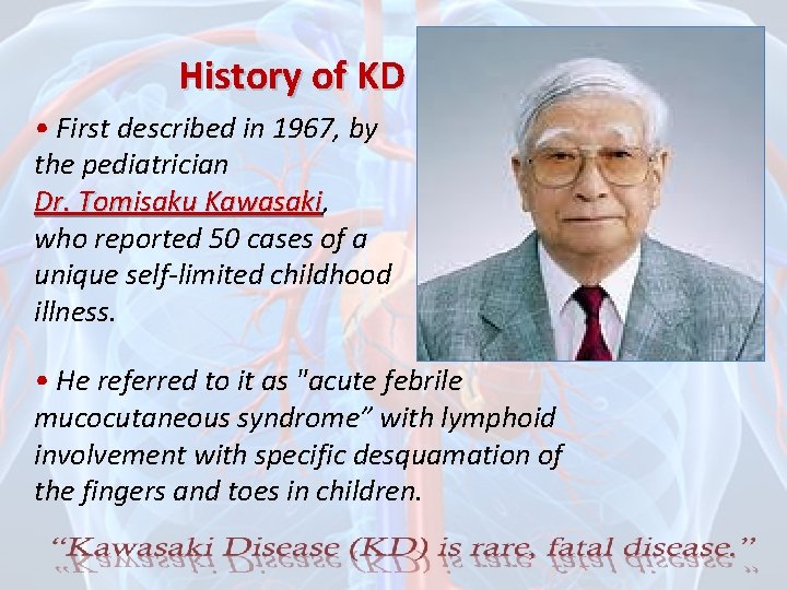 History of KD • First described in 1967, by the pediatrician Dr. Tomisaku Kawasaki,