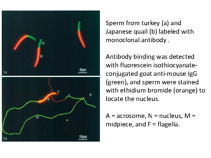 Sperm from turkey (a) and Japanese quail (b) labeled with monoclonal antibody. Antibody binding Sperm from turkey (a) and Japanese quail (b) labeled with monoclonal antibody. Antibody binding