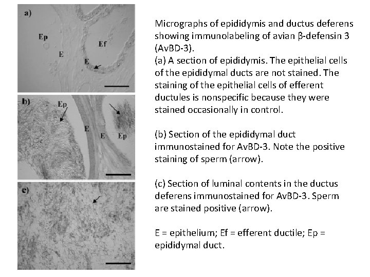 Micrographs of epididymis and ductus deferens showing immunolabeling of avian β-defensin 3 (Av. BD-3). Micrographs of epididymis and ductus deferens showing immunolabeling of avian β-defensin 3 (Av. BD-3).