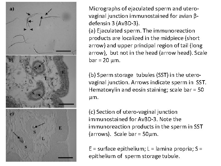 Micrographs of ejaculated sperm and uterovaginal junction immunostained for avian βdefensin 3 (Av. BD-3). Micrographs of ejaculated sperm and uterovaginal junction immunostained for avian βdefensin 3 (Av. BD-3).
