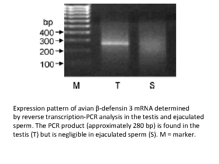 Expression pattern of avian β-defensin 3 m. RNA determined by reverse transcription-PCR analysis in Expression pattern of avian β-defensin 3 m. RNA determined by reverse transcription-PCR analysis in