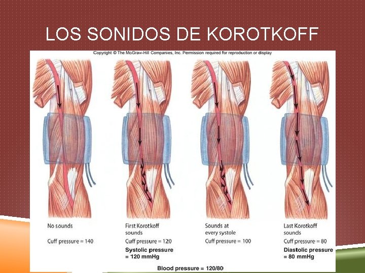 LOS SONIDOS DE KOROTKOFF 