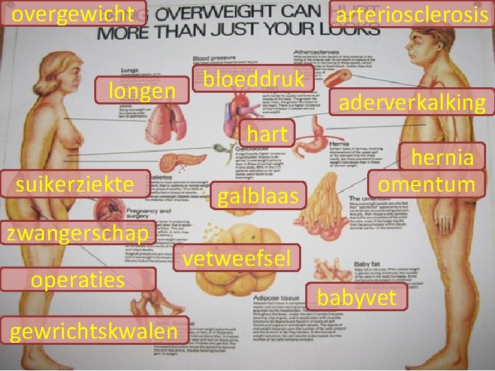 overgewicht longen arteriosclerosis bloeddruk hart suikerziekte zwangerschap operaties gewrichtskwalen galblaas aderverkalking hernia omentum vetweefsel