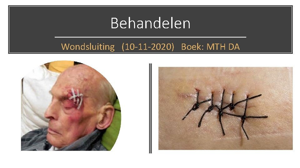 Behandelen Wondsluiting (10 -11 -2020) Boek: MTH DA 
